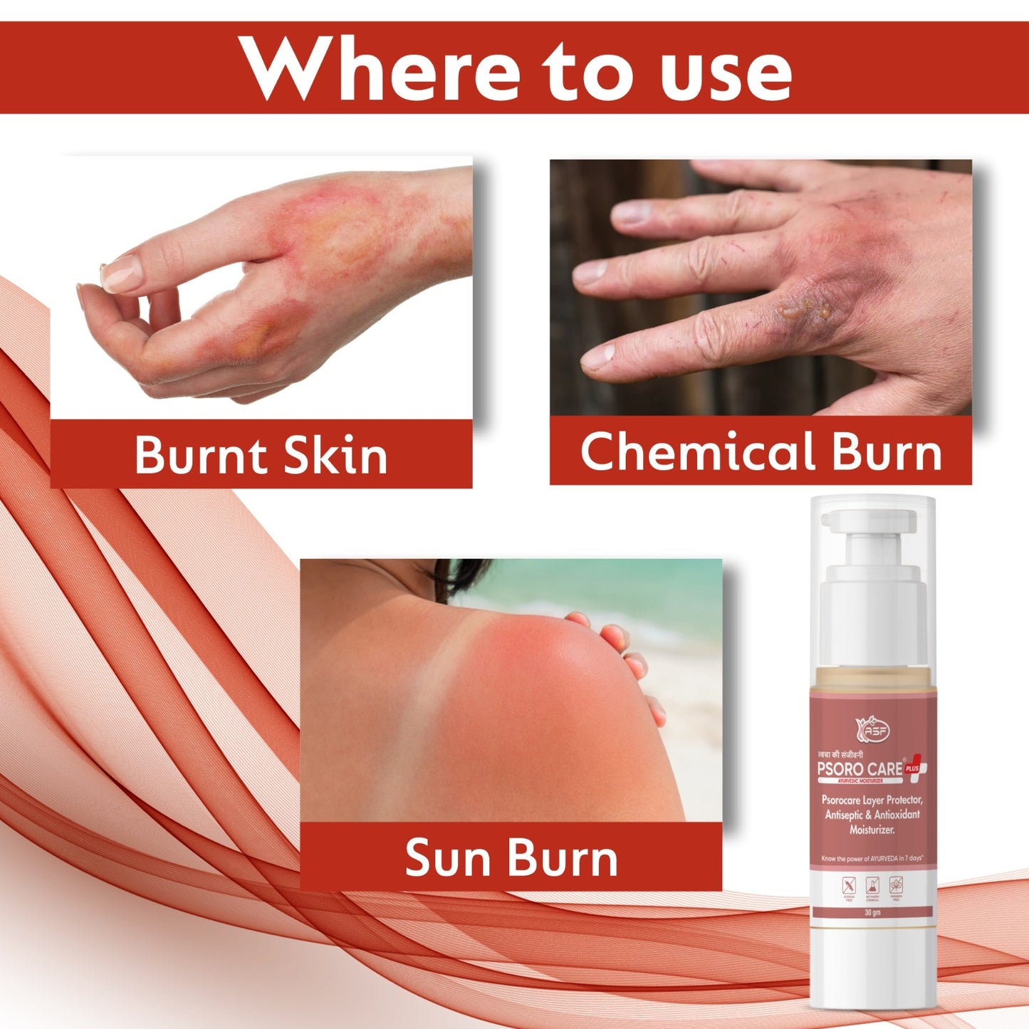 Psorocare Ayurvedic Layer Protector For Psoriasis And Eczema | Aids in Redness, Irritation and Minor Skin Cut | For Sun Burn, Acne Prone, Cosmetic Burn 30 GM | Pack of 1