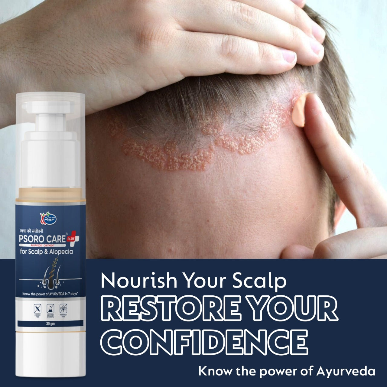 Psoro Care for Scalp & Alopecia - 30gm
